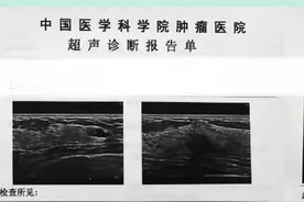 4b类的结节应该怎么办？ #医学科普 #健康科普 #乳腺健康 #乳腺癌 #乳腺结节视频封面