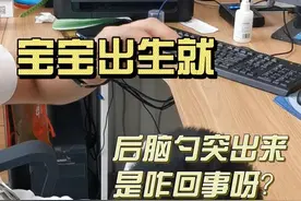 宝宝出生就后脑勺突出来，究竟是咋回事？#枕骨突出视频封面