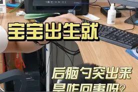 宝宝出生就后脑勺突出来，究竟是咋回事？#枕骨突出视频封面