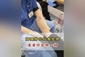 脚踝肿是一种比较难看的疾病，看看你是哪一种 #足踝 #脚肿了疼痛不能走路 #脚肿 #医学科普
