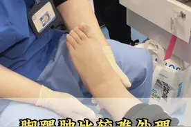脚踝肿是一种比较难看的疾病，看看你是哪一种 #足踝 #脚肿了疼痛不能走路 #脚肿 #医学科普视频封面