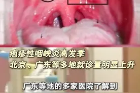 幼儿群体易感染，疱疹性咽颊炎仍多见#视频仅供参考如有不适请线下就医 #医学科普 #疱疹性咽峡炎视频封面