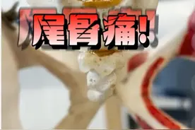 #尾骨 #尾骨痛 #缓解方法 #运动康复锻炼 @小荷医典 @抖音短视频视频封面