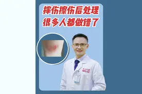#摔伤 #擦伤 后处理，很多人都做错了#医学科普 #急救 #生活常识