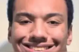 九龙科技竟然能改变面相 #轮子哥 #类固醇 #健美视频封面