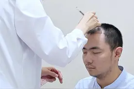双胞胎植发实录之弟弟植发过程分享，松弛感拿捏！ #植发 #发际线种植 #脱发 #脱发怎么办 #硬核健康科普行动视频封面