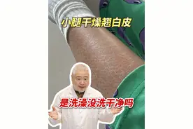 小腿干燥像“鱼鳞”，一脱裤子“雪花”飞，这个妙招能帮你！#硬核健康科普行动  10%#尿素身体乳 #鱼鳞病 #冬天 #干燥视频封面