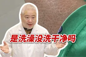 小腿干燥像“鱼鳞”，一脱裤子“雪花”飞，这个妙招能帮你！#硬核健康科普行动  10%#尿素身体乳 #鱼鳞病 #冬天 #干燥视频封面