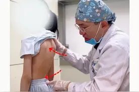 儿童 | 驼背 | 骨盆前倾 | 较为明显？ 没关系！ 暑假假期孙教授分享两个动作！ 在家练一练！#耸肩驼背 #脖子前倾 #骨盆前倾 #不良体态纠正 #抖出健康知识宝藏