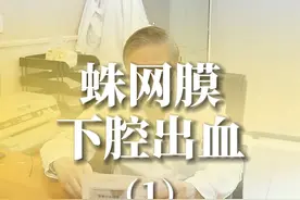 59岁，在工厂上班，从梯子上摔落，后脑受伤严重损害，#医学科普 #脑外伤 #蛛网膜下腔出血 #硬核健康科普行动  #周范民