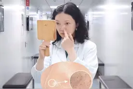 黑头闭口真烦人！千万别挤，这样处理才正确 #黑头 #闭口 #护肤 #科普 #皮肤  视频封面