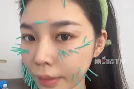 #女子想改善下颌线和黑眼圈尝试中医美容针灸 ，当事人很惊讶：40分钟拔掉后有明显的提升效果，肤色也变亮了！当时抱着试一试态度去的，没想到给了这么大的惊喜”。#中医 #中医针灸 #中医文化视频封面