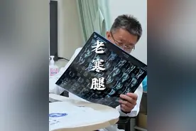 老寒腿 #老寒腿 其实是外伤或者老化导致的#骨关节炎，如果关节开始出现怕冷、变天出现疼痛等症状，需要及时注意保暖和治疗哦。#医学科普#硬核健康科普行动 #田洪涛医生视频封面