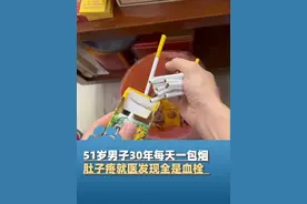 4月28日河南郑州，51岁男子30年每天一包烟，肚子疼就医发现全是血栓，医生：长期吸烟导致该指标升高，患者属于肠梗，不及时治疗危及生命#河南dou知道
