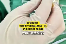 惊！男子蹲坑2小时肠子掉出13厘米。蹲坑玩手机的习惯太危险，医生：蹲超10分钟，风险直线上升。#脱肛  #肛肠科视频封面