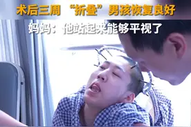 6月15号，北京，首次手术后第三周，“折叠”男孩恢复良好。妈妈：站起来可以平视了，感谢帮助他们的医护人员。#折叠男孩的心愿视频封面