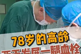 78岁的患者，短短两天的时间发展了一腿的血栓。#马云龙主任  #静脉曲张微创  #静脉曲张 #抖出健康知识宝藏视频封面