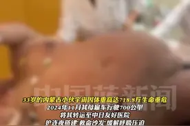 33岁小伙体重718.8斤，每天要吃3到5顿饭，每顿25个包子，55天减重230斤后做了胃切除手术，目前已经成功瘦到了400斤以下。视频封面