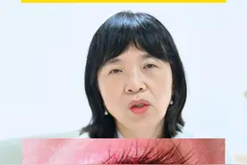 眼睛有红血丝滴什么眼药水？#眼睛有红血丝   #健康科普  #眼科教授晏晓明视频封面