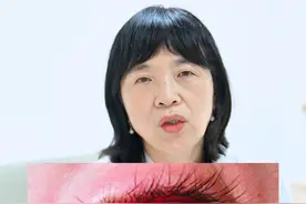 眼睛有红血丝滴什么眼药水？#眼睛有红血丝   #健康科普  #眼科教授晏晓明视频封面