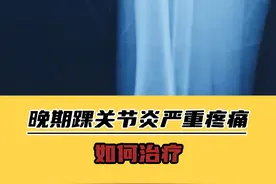 晚期踝关节炎严重疼痛，如何治疗？ #医学科普 #运动康复 #抖出健康知识宝藏视频封面