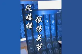 外卖员长期爬楼半月板三度损伤 医：建议做手术 不然关节磨坏了#跑外卖 #膝关节 #门诊日常