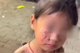 被榴莲砸伤面部的小女孩事件后续：商家拒绝赔偿！视频封面
