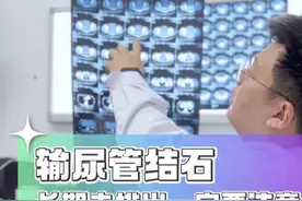 输尿管结石长期嵌顿 输尿管小结石并不可怕，相当一部分可以通过保守治疗排出。但是，当长期无法排出时，务必尽早处理，避免长期嵌顿造成输尿管受损狭窄。#输尿管结石 #肾积水 #输尿管狭窄 #输尿管镜 #硬核健康科普行动视频封面