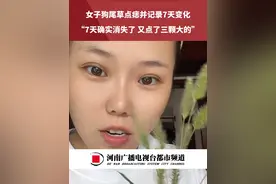 女子狗尾草点痣并记录7天变化，“7天确实消失了，又点了三颗大的”#点痣 #社会百态 #万万没想到