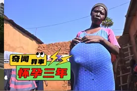 女人怀了两对龙凤胎，肚子无比巨大 #奇闻奇事 #纪录片视频封面