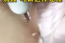 脖子上的小肉丁，不要拔！可以这样处理  #hpv  #丝状疣   #科普  #女性  #皮肤视频封面