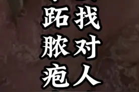 掌跖脓疱病要找对人治，不要治好皮疹脓疱又起来了！ #掌跖脓疱病 #掌跖脓疱病怎么办 #医学科普视频封面
