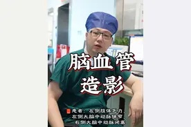 患者左侧肢体乏力，脑血管造影发现左侧大脑中动脉狭窄，右侧大脑中动脉闭塞！大家平时一定要做好脑血管病的筛查！#患者故事 #外科手术 #脑血管造影 #硬核健康科普行动 #阿璐医生聊健康视频封面