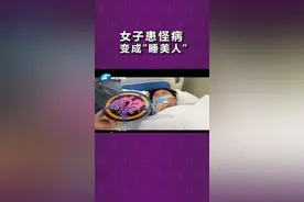 河南郑州：现实版“睡美人”！女子患怪病总睡觉，醒来后谁也不记得#怪病 #河南dou知道 @《小莉帮忙》刘小莉 视频封面