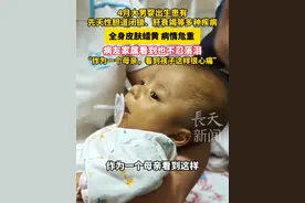 4月大男婴出生患有先天性胆道闭锁、肝衰竭等多种疾病 全身皮肤蜡黄 病情危重 病友家属看到也不忍落泪 “作为一个母亲，看到孩子这样很心痛”#广西小黄人千里转运北京  #广西小明千里转运换肝 #广西4月大婴儿小明转运北京 #广西“小黄人”