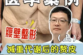 减重代谢后的赘皮(上)，难以启齿的自卑 #腹壁整形 #腹壁成型 #八大处金骥 #减重后赘皮 #案例讲解