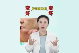 怎么辨别黄褐斑加重了还是要消退？ #黄褐斑 #反黑 #皮肤美容 #祛斑 #硬核健康科普行动视频封面
