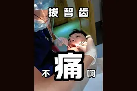 小小智齿 拿下 #搞笑 #拔牙 #反转 #智齿 #嘴硬视频封面