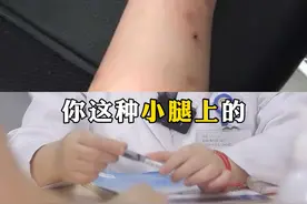 小腿上都是#蚊子咬过的#黑印，太丑了，夏天不敢露腿怎么办#医学科普 #健康 #皮肤 视频封面