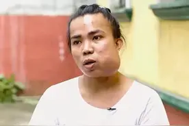 女人因为长期吃槟榔，导致口腔严重溃烂肿起 #纪录片 #万万没想到