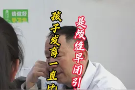孩子发育一直比同龄人慢，是不是颅缝早闭造成的？#医学科普 #发育迟缓 #我的门诊故事 #医学科普仅供参考如有不适请线下就医 #颅缝早闭视频封面