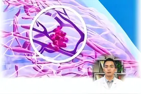 乳腺长了结节 卵巢和子宫部位 何大夫也建议您检查 别怪我没提醒您#医疗科普#健康科普#抖出健康知识宝藏视频封面