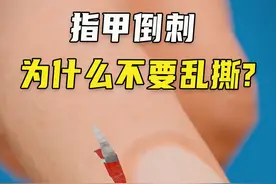 为什么指甲倒刺不要乱撕？后果你绝对想不到！ #涨知识 #指甲倒刺 #指甲  #科普一下 #倒刺视频封面