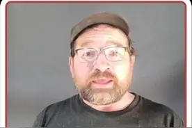 戴维斯用最低的成本完成自己的机械治愈 #赛博朋克 #义肢 #感人 #残疾人 #机械视频封面