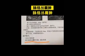 太多准爸妈来问了：脉络丛囊肿到底是个啥？#脉络丛囊肿 #产检一路绿灯 #父母必看系列 #医学科普