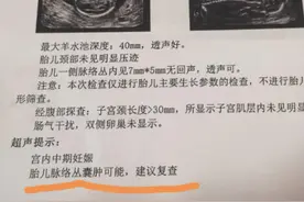 太多准爸妈来问了：脉络丛囊肿到底是个啥？#脉络丛囊肿 #产检一路绿灯 #父母必看系列 #医学科普