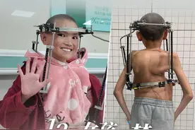 第1眼看见 | 患有重度脊柱侧弯的12岁女孩拉姆，身体里现在竟有12颗钢钉，最长的有40厘米！从西藏来到重庆治病的她，即将迎来第二场手术。她想实现自己的梦——穿漂亮裙子回草原跳舞！#媒体精选计划视频封面