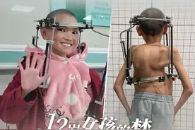 第1眼看见 | 患有重度脊柱侧弯的12岁女孩拉姆，身体里现在竟有12颗钢钉，最长的有40厘米！从西藏来到重庆治病的她，即将迎来第二场手术。她想实现自己的梦——穿漂亮裙子回草原跳舞！#媒体精选计划视频封面