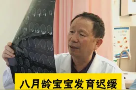 八个月宝宝发育迟缓，抓行、回应、左立均显落后#医学科普 #我的门诊故事 #门诊日常 #发育迟缓 #医者仁心视频封面