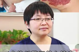 4个信号警示着血管瘤，可能变得越来越严重 #血管瘤  #宝宝血管瘤 #胎记 #硬核健康科普行动  #医疗健康训练营视频封面